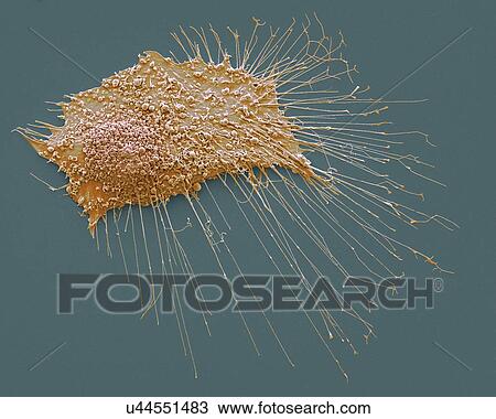 Bone cancer cell, SEM View Large Illustration Drawing - Bone cancer cell, SEM. Fotosearch