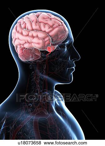 Brain aneurysm, artwork View Large Illustration Stock Illustration - Brain aneurysm, artwork. Fotosearch