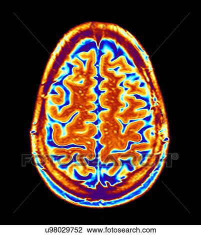 Brain scan, MRI scan View Large Illustration Drawing - Brain scan, MRI scan. Fotosearch