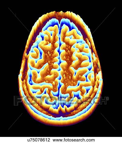 Drawing - Brain scan, MRI scan, heightmap. Fotosearch