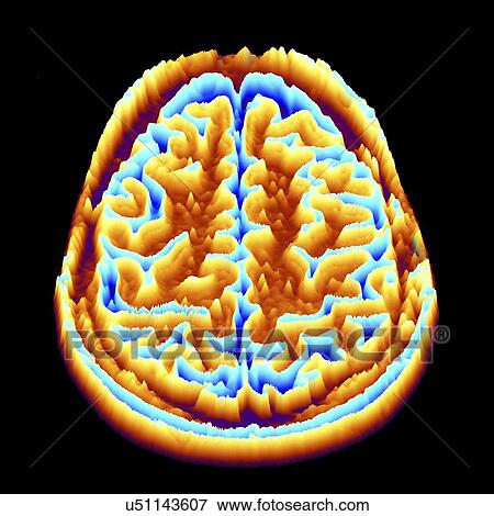 Stock Illustration - Brain scan, MRI scan, heightmap. Fotosearch