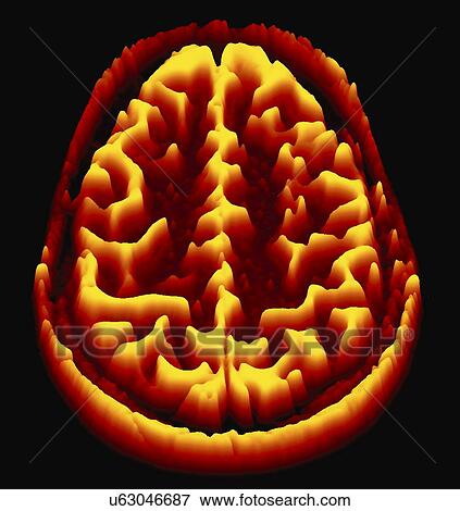 Brain scan, MRI scan, heightmap View Large Illustration Stock Illustration - Brain scan, MRI scan, heightmap. Fotosearch