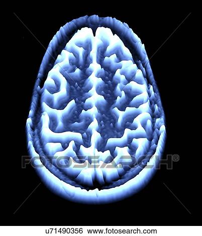 Stock Illustration - Brain scan, MRI scan, heightmap. Fotosearch