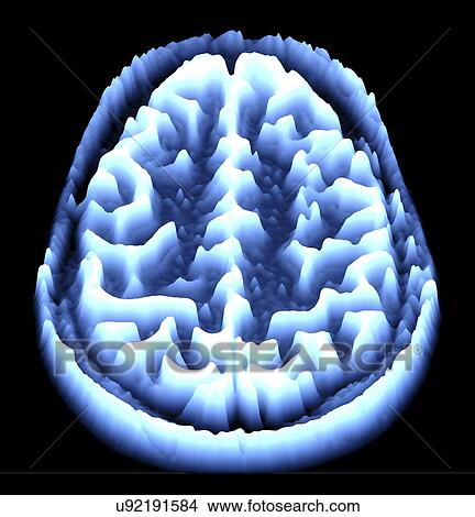 Brain scan, MRI scan, heightmap View Large Illustration Stock Illustration - Brain scan, MRI scan, heightmap. Fotosearch