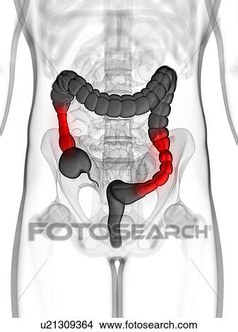 Stock Illustration - Colonic spasm, artwork. Fotosearch