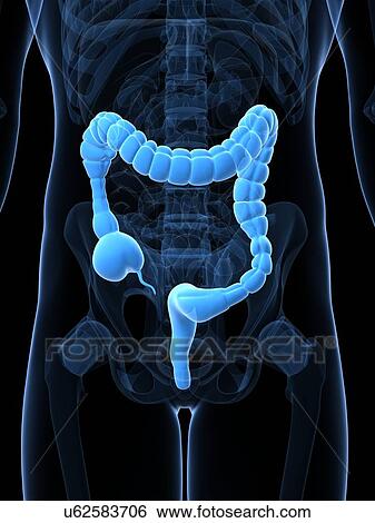 Stock Illustration - Colonic spasm, artwork. Fotosearch