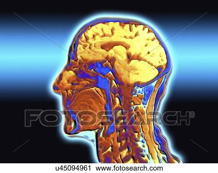 Clip Art - Coloured MRI scan of the human head. Fotosearch