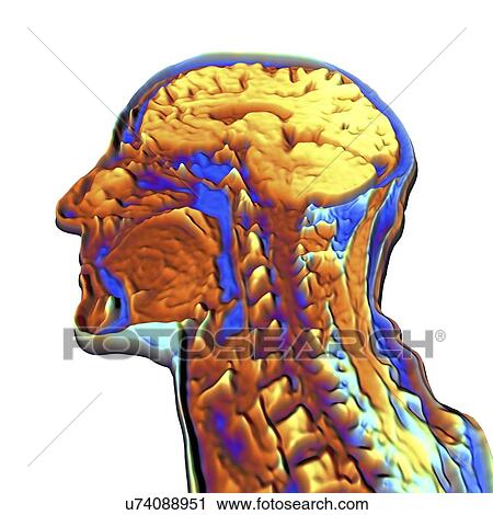 Coloured MRI scan of the human head View Large Illustration Clip Art - Coloured MRI scan of the human head. Fotosearch