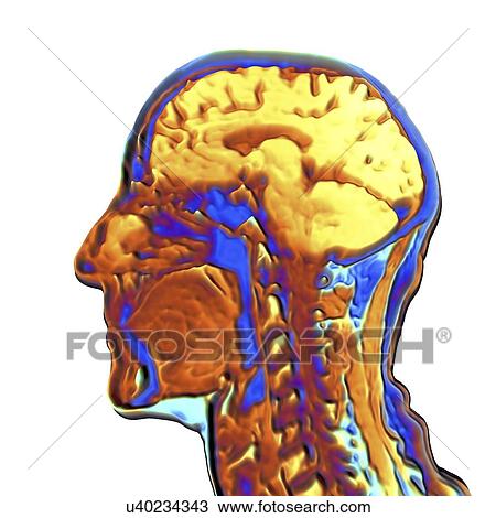 Drawing - Coloured MRI scan of the human head. Fotosearch