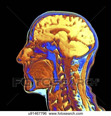 Stock Illustration - Coloured MRI scan of the human head. Fotosearch