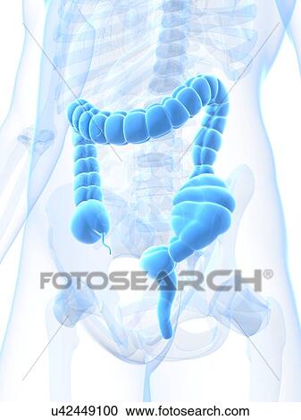Constipated colon, artwork View Large Illustration Clipart - Constipated colon, artwork. Fotosearch