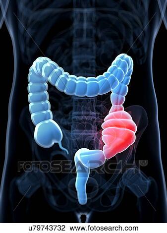 Constipated colon, artwork View Large Illustration Drawing - Constipated colon, artwork. Fotosearch