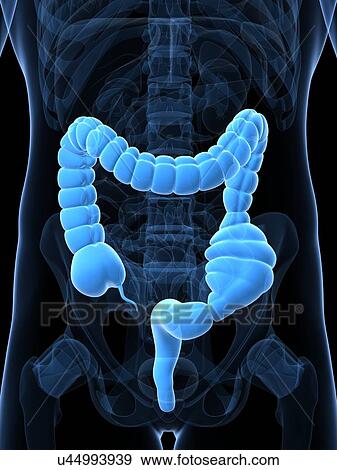 Constipated colon, artwork View Large Illustration Stock Illustration - Constipated colon, artwork. Fotosearch