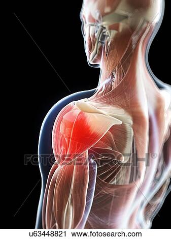 Deltoid pain, conceptual artwork View Large Illustration Clip Art - Deltoid pain, conceptual artwork. Fotosearch