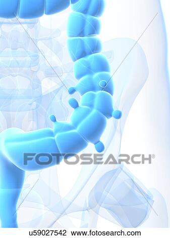 Diverticulosis, artwork View Large Illustration Drawing - Diverticulosis, artwork. Fotosearch