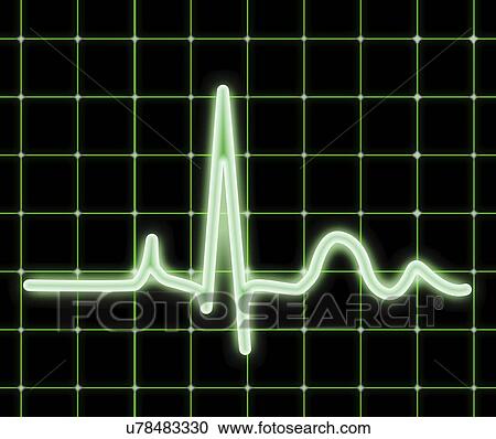 Clipart - ECG, artwork. Fotosearch