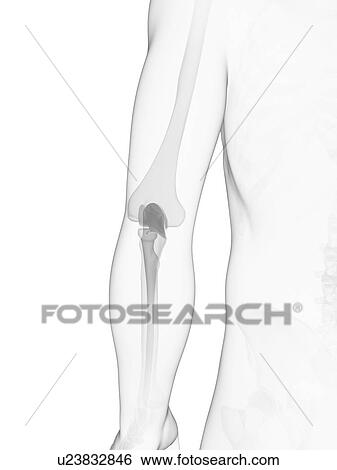 Elbow joint, artwork View Large Illustration Stock Illustration - Elbow joint, artwork. Fotosearch