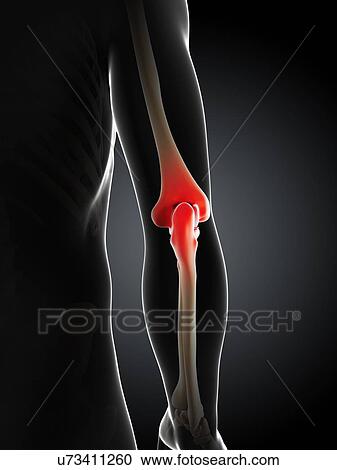 Elbow pain, conceptual artwork View Large Illustration Clipart - Elbow pain, conceptual artwork. Fotosearch