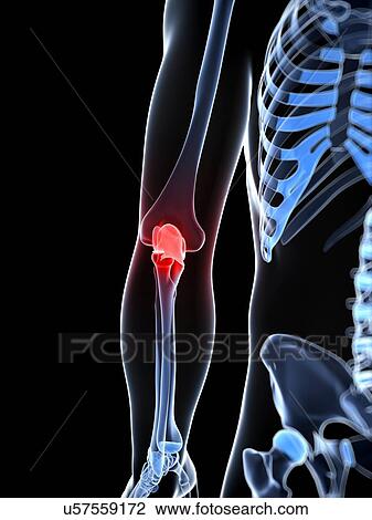 Drawing - Elbow pain, conceptual artwork. Fotosearch