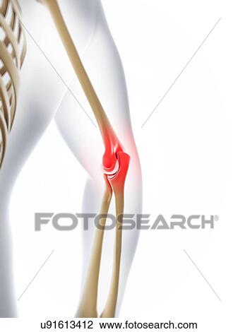 Elbow pain, conceptual artwork View Large Illustration Drawing - Elbow pain, conceptual artwork. Fotosearch