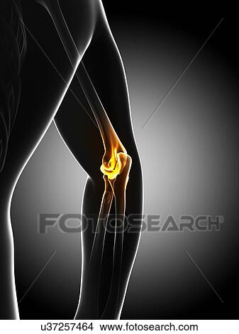 Elbow pain, conceptual artwork View Large Illustration Stock Illustration - Elbow pain, conceptual artwork. Fotosearch