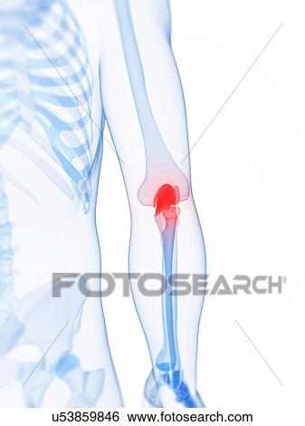 Elbow pain, conceptual artwork View Large Illustration Stock Illustration - Elbow pain, conceptual artwork. Fotosearch
