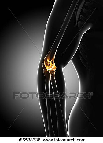 Elbow pain, conceptual artwork View Large Illustration Stock Illustration - Elbow pain, conceptual artwork. Fotosearch