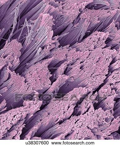 Clipart - Fractured tendon, SEM. Fotosearch