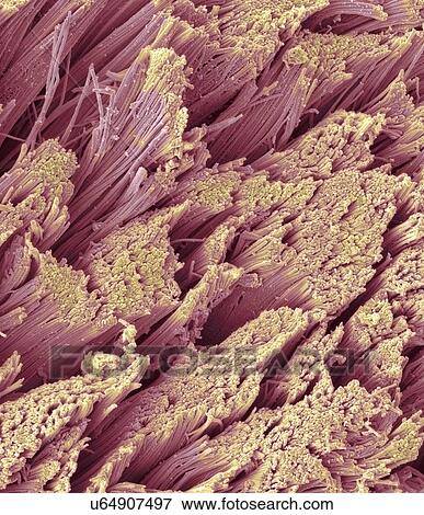 Stock Illustration - Fractured tendon, SEM. Fotosearch