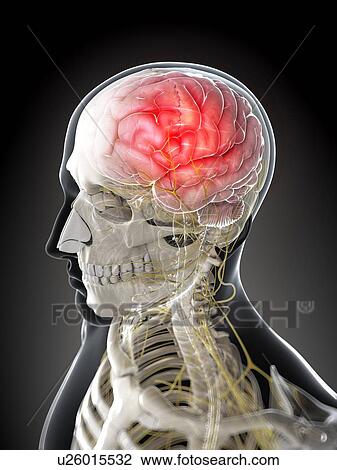 Drawing - Headache, artwork. Fotosearch