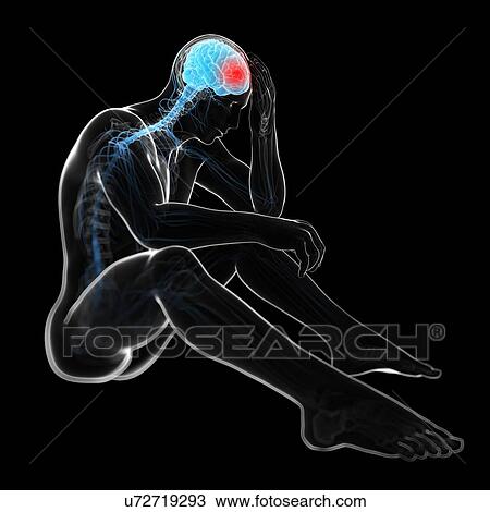 Drawing - Headache, artwork. Fotosearch
