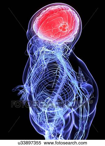 Headache, conceptual artwork View Large Illustration Stock Illustration - Headache, conceptual artwork. Fotosearch