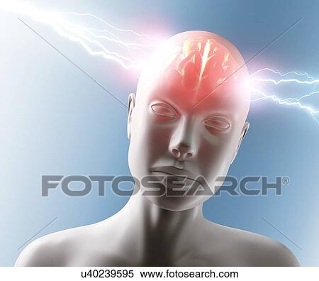 Headache, conceptual artwork View Large Illustration Stock Illustration - Headache, conceptual artwork. Fotosearch