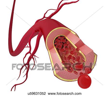 Healthy artery, artwork View Large Illustration Drawing - Healthy artery, artwork. Fotosearch