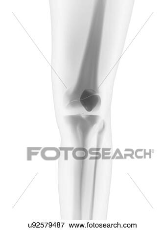 Stock Illustration - Healthy knee, artwork. Fotosearch