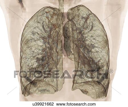 Healthy lungs, 3D CT scan View Large Illustration Drawing - Healthy lungs, 3D CT scan. Fotosearch