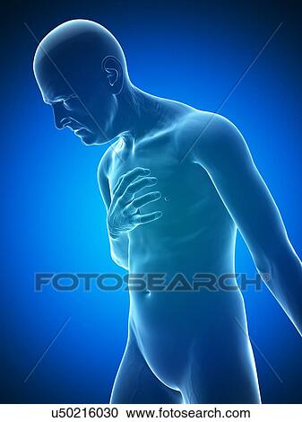 Heart attack, artwork View Large Illustration Clipart - Heart attack, artwork. Fotosearch
