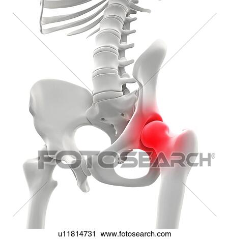 Hip pain, conceptual artwork View Large Illustration Clip Art - Hip pain, conceptual artwork. Fotosearch