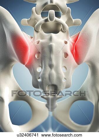Hip pain, conceptual artwork View Large Illustration Clip Art - Hip pain, conceptual artwork. Fotosearch