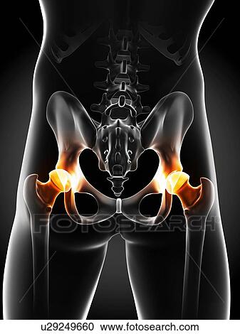 Hip pain, conceptual artwork View Large Illustration Clipart - Hip pain, conceptual artwork. Fotosearch