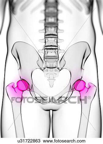 Drawing - Hip pain, conceptual artwork. Fotosearch
