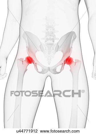 Hip pain, conceptual artwork View Large Illustration Drawing - Hip pain, conceptual artwork. Fotosearch