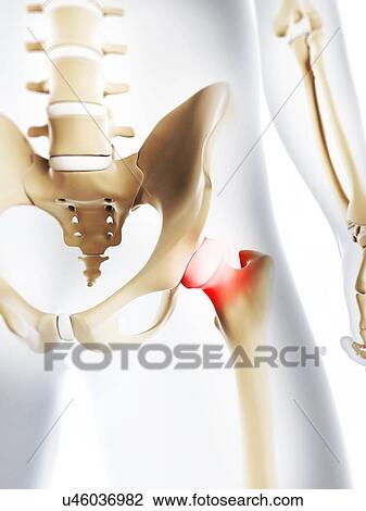 Hip pain, conceptual artwork View Large Illustration Drawing - Hip pain, conceptual artwork. Fotosearch