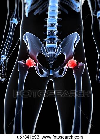 Drawing - Hip pain, conceptual artwork. Fotosearch