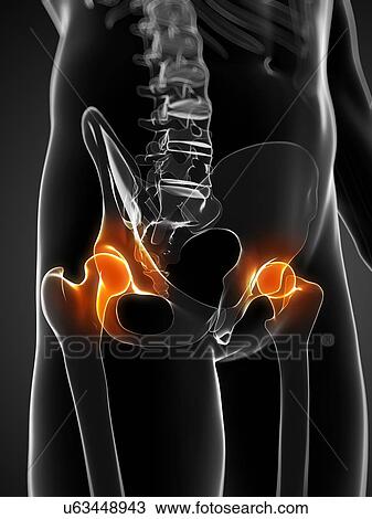 Hip pain, conceptual artwork View Large Illustration Drawing - Hip pain, conceptual artwork. Fotosearch