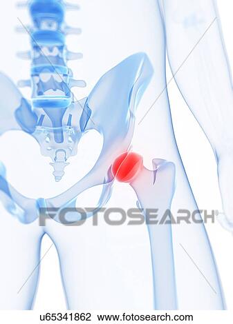 Drawing - Hip pain, conceptual artwork. Fotosearch