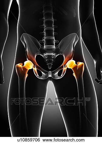 Stock Illustration - Hip pain, conceptual artwork. Fotosearch