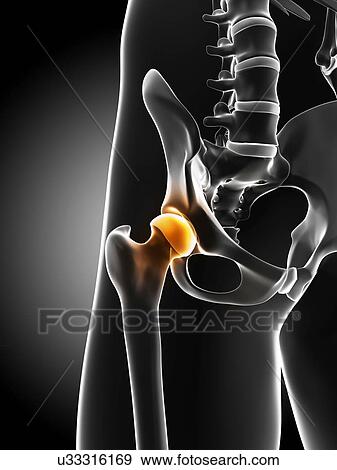 Hip pain, conceptual artwork View Large Illustration Stock Illustration - Hip pain, conceptual artwork. Fotosearch