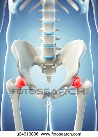 Hip pain, conceptual artwork View Large Illustration Stock Illustration - Hip pain, conceptual artwork. Fotosearch
