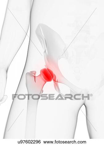 Hip pain, conceptual artwork View Large Illustration Stock Illustration - Hip pain, conceptual artwork. Fotosearch